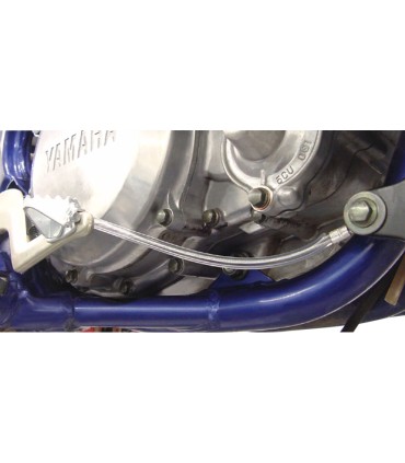 Pedal Anchor Kit: Universal fo